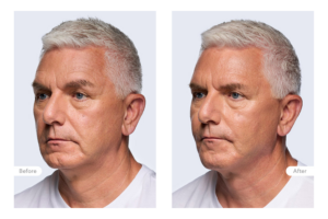 Clinical Outcomes John